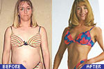Before/After Weight Loss Picture No. 4