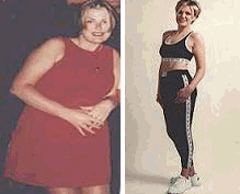 Before After Weight Loss Picture No. 5