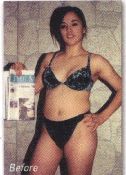 Before After Weight Loss No. 5