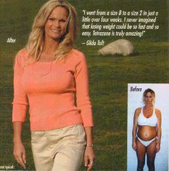 Before After Weight Loss No. 7